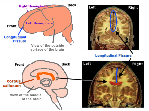 [Cerebrum]