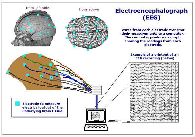 [EEG Diagram]