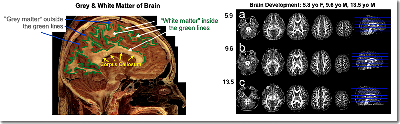 Grey vs. white matter
