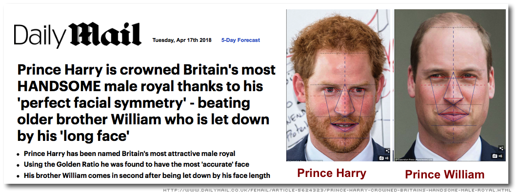Facial
              Symmetry - Prince Harry