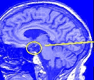 [Brain Hypothalamus]