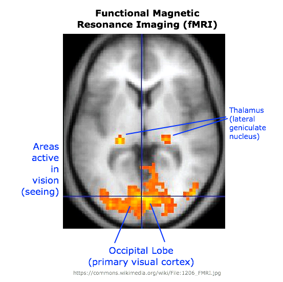 fMRI