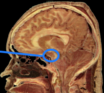 Hypothalamus (Visible Human Female)