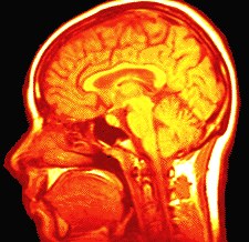 brain