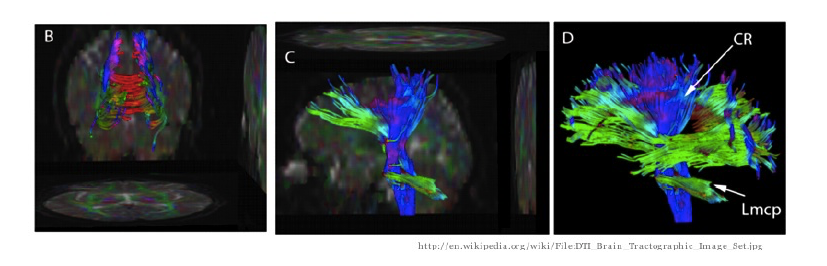 Images of DTI Studies