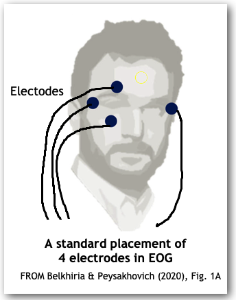 Electrode
              placement in EOG