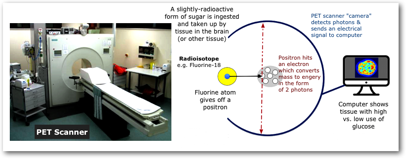 Pet
            scan working
