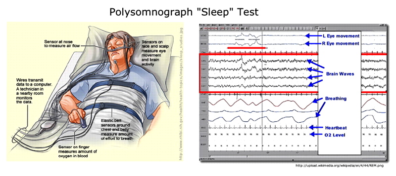 Polysomnograph