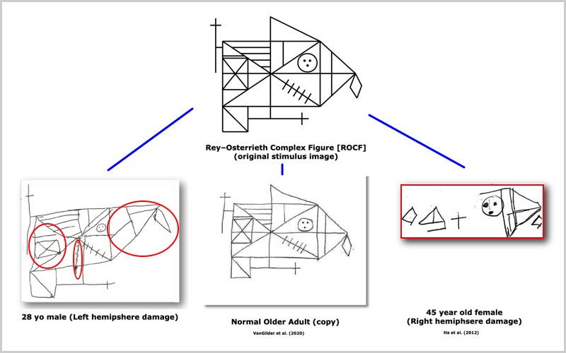 ROCF
                        Examples