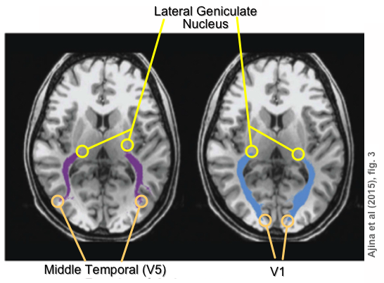 Blindsight
              Explanation