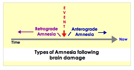 [Types of Amnesia]
