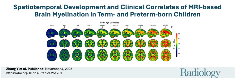 Myelination in infancy and early childhood
