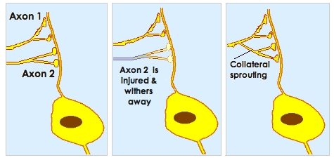 [Collateral sprouting]