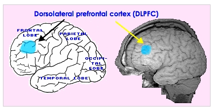 [Dorsolateral prefrontal
                cortex]