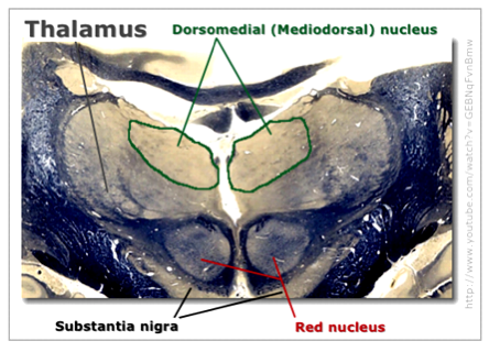 [dorsomedial nucleus]
