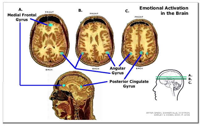 Emotional activation of the brain (Green)