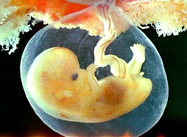 [fetus image]