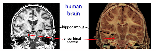hippocampus
                & entrorhinal cortex