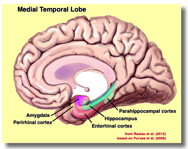 Medial
            Temporal Lobe