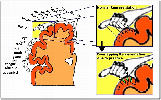 overrepresentation (focal hand dystonia)