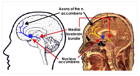 nucleus accumbens