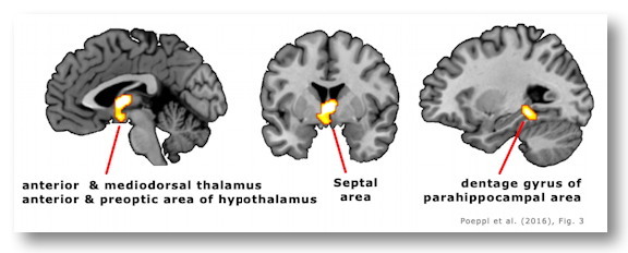 Neural circuit for sexual preference