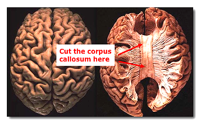 split brain