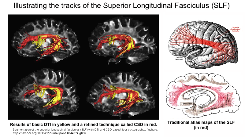 SLF in multiple views