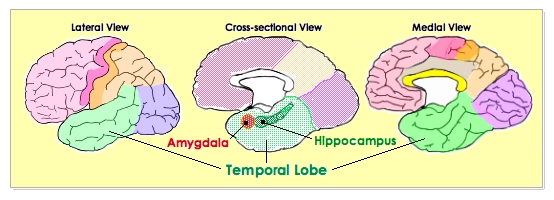 [Temporal Lobe]