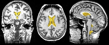 Ventricles
                (2)