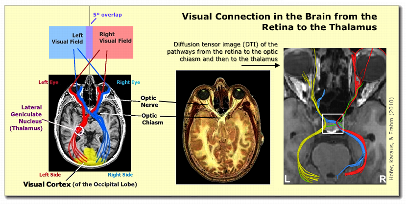 [Visual System connections]