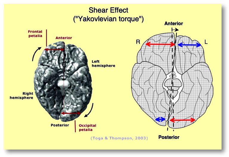 Shear Effect
          (Yakovlevian Torque)