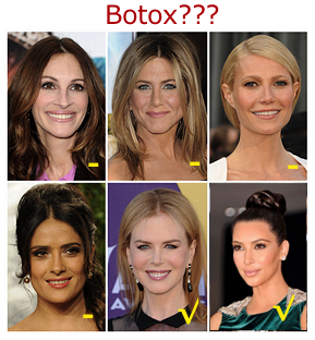Botox