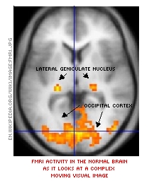 fMRI of occipital lobe