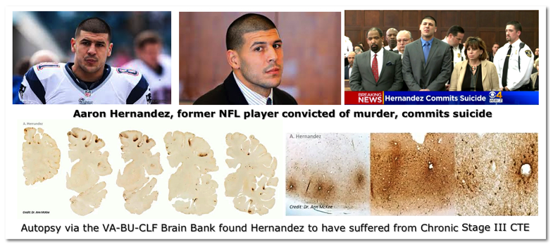 Aaron
            Hernandez CTE