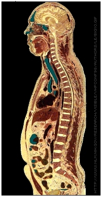 Visible
            Human Head & Torso