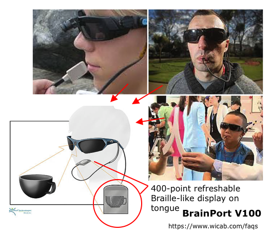 BrainPort
                  TVSS