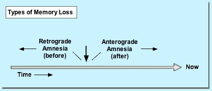 [Types of Amnesia]