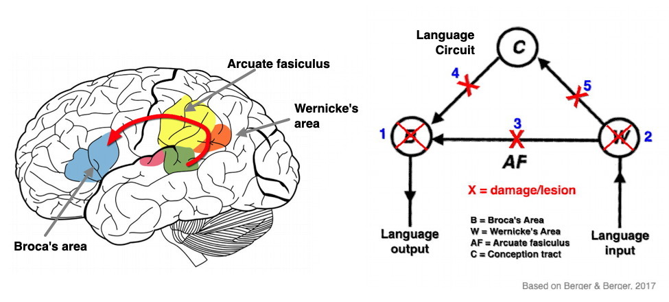 Neurobiology of Language Disorders
