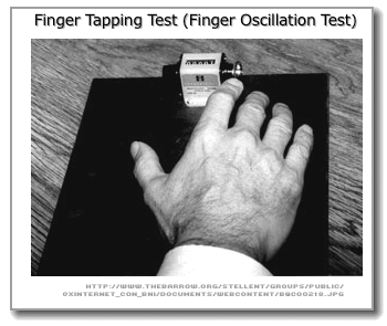 [Finger Tapping Test]