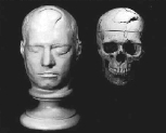 [Phineas Gage]