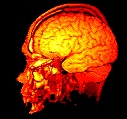 [Brain
                      MRI Image]